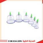 كاسات حجامة